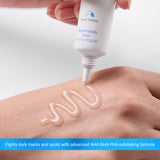 Perdura SeboPeel Acne & Spot Correcting Peel (20 ml)