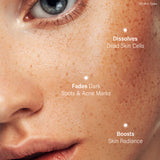 Perdura SeboPeel Acne & Spot Correcting Peel (20 ml)