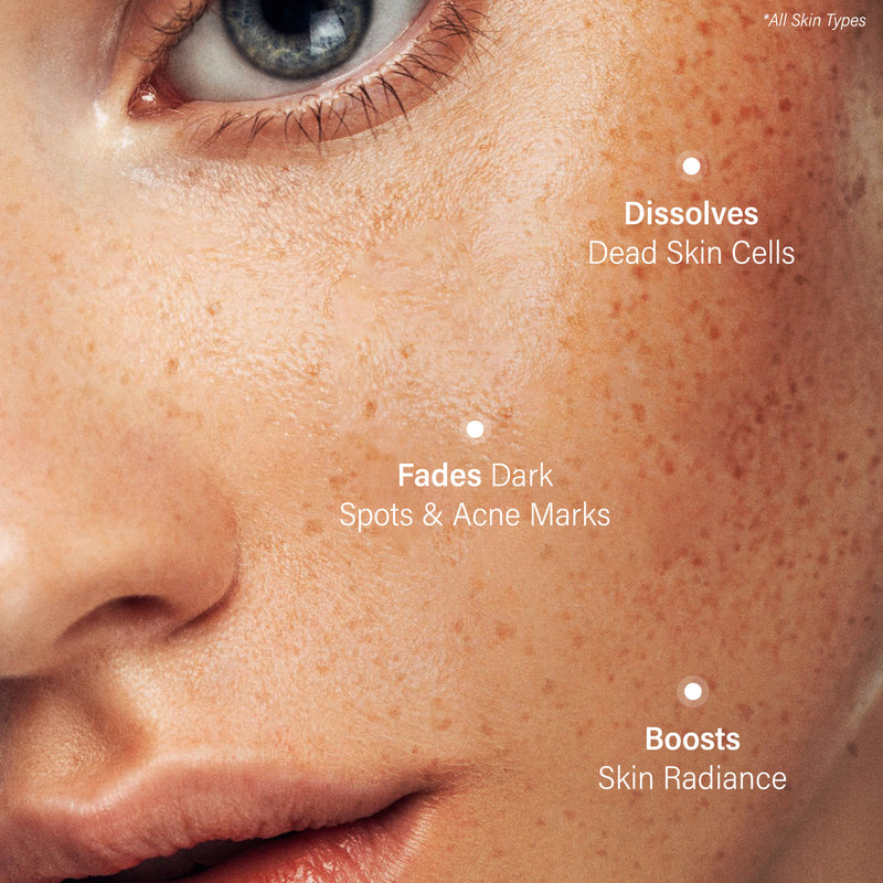 Perdura SeboPeel Acne & Spot Correcting Peel (20 ml)